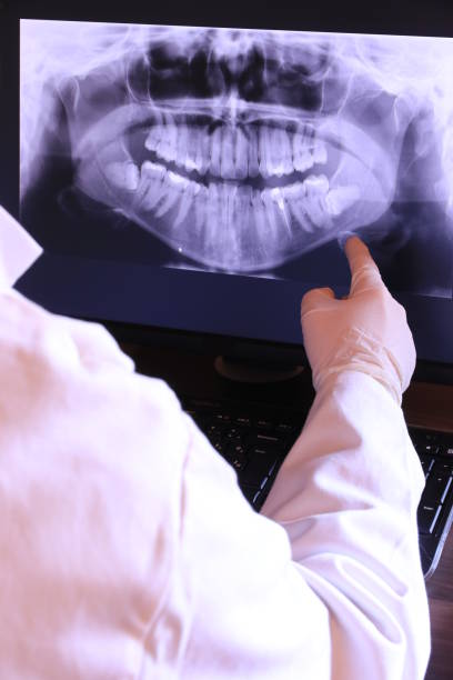 Best Emergency Wisdom Teeth Removal in Catalina, AZ